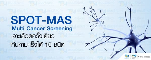 SPOT-MAS เจาะเลือดครั้งเดียว ตรวจหามะเร็งได้ 10 ชนิด