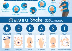 สัญญาณเตือน Stroke