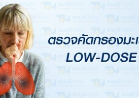 ตรวจคัดกรองมะเร็งปอด Low-Dose CT รพ.ธนบุรี ทุ่งสง