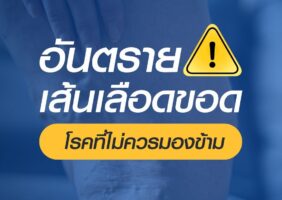 เลเซอร์รักษาเส้นเลือดขอด รพ.ธนบุรี ทุ่งสง