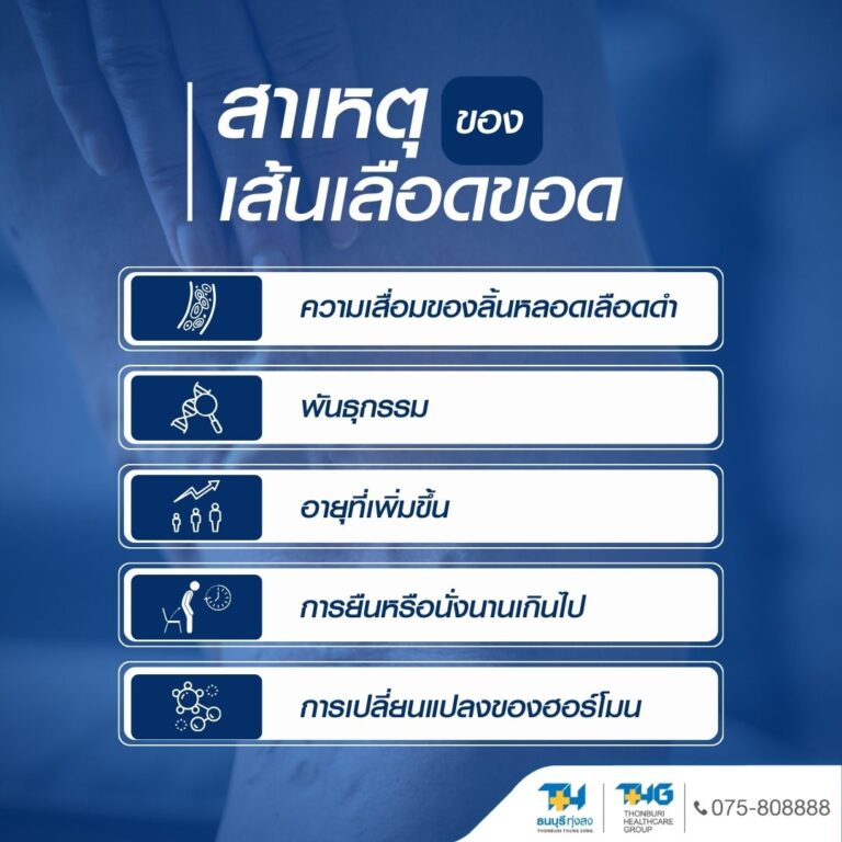 สาเหตุเส้นเลือดขอด อินโฟกราฟิก 