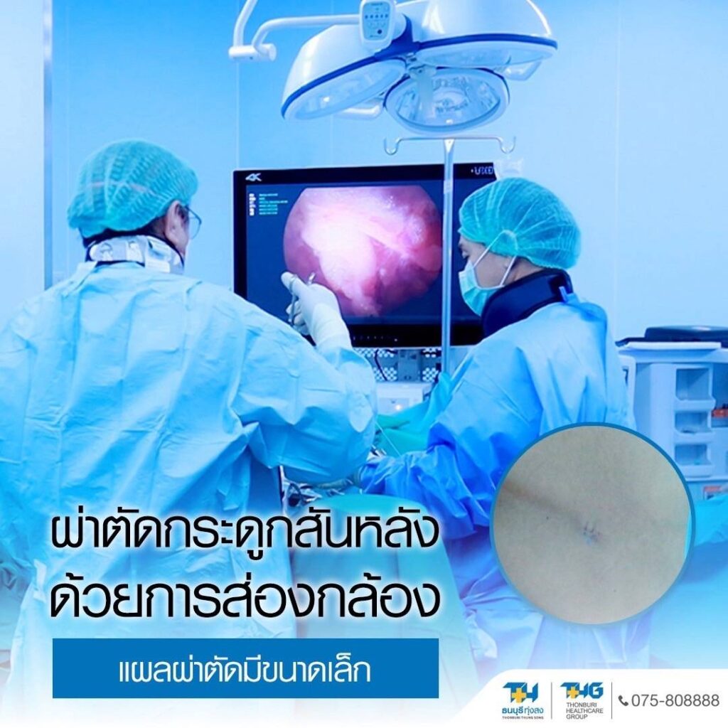 ผ่าตัดกระดูกสันหลังด้วยกล้อง แผลเล็ก รพ.ธนบุรี ทุ่งสง