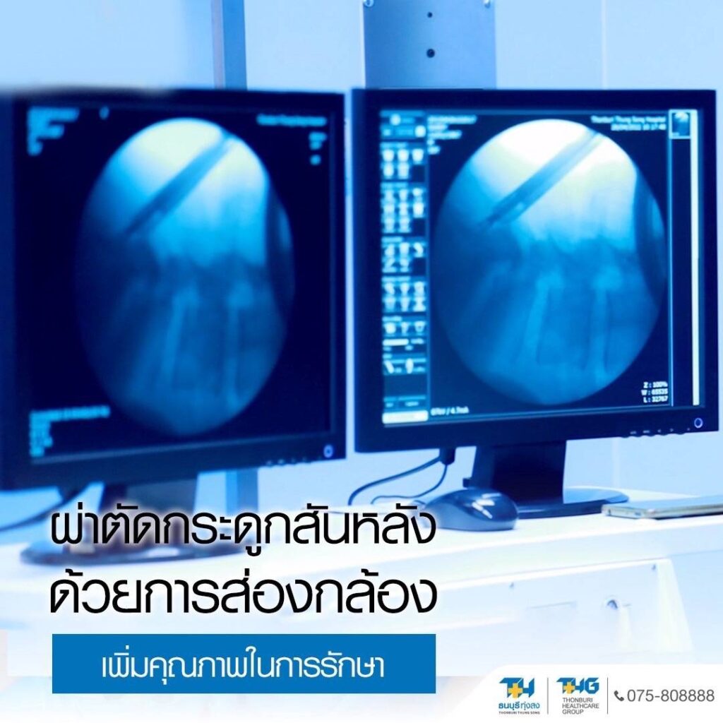 ภาพ X-ray หลังผ่าตัดกระดูกสันหลัง รพ.ธนบุรี ทุ่งสง