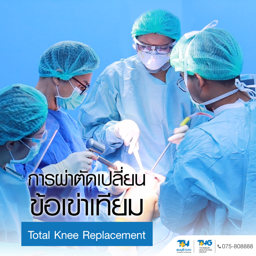 ทีมแพทย์ผ่าตัดข้อเข่าเทียม โรงพยาบาลธนบุรี ทุ่งสง