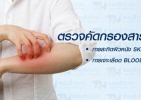 แพ็กเกจตรวจภูมิแพ้ Skin Test Blood Test โรงพยาบาลธนบุรี ทุ่งสง
