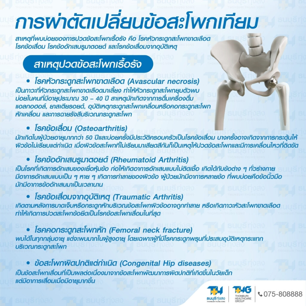 สาเหตุปวดข้อสะโพกเทียม การผ่าตัดเปลี่ยนข้อสะโพก โรงพยาบาลธนบุรี
